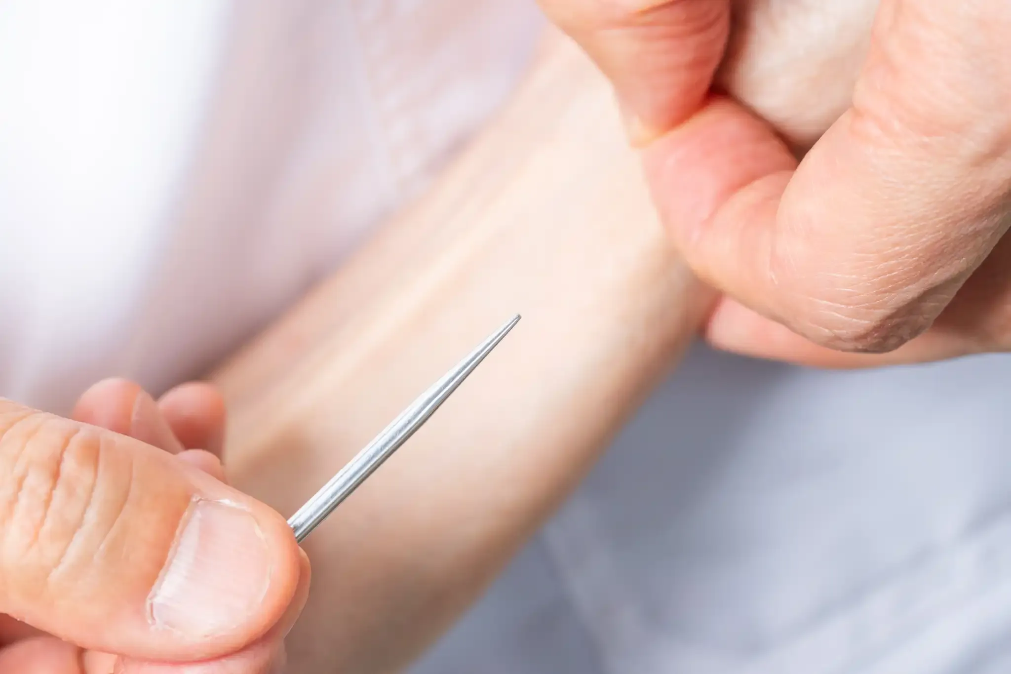 【福岡県北九州市小倉北区で店舗施術中撮影】東洋鍼灸 楽様4